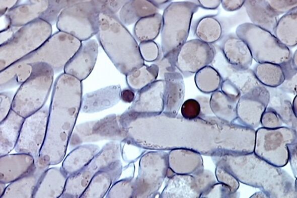 tırnak mantarı hücreleri mikroskop altında