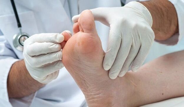 mantarın doktor tarafından tedavisi ve teşhisi