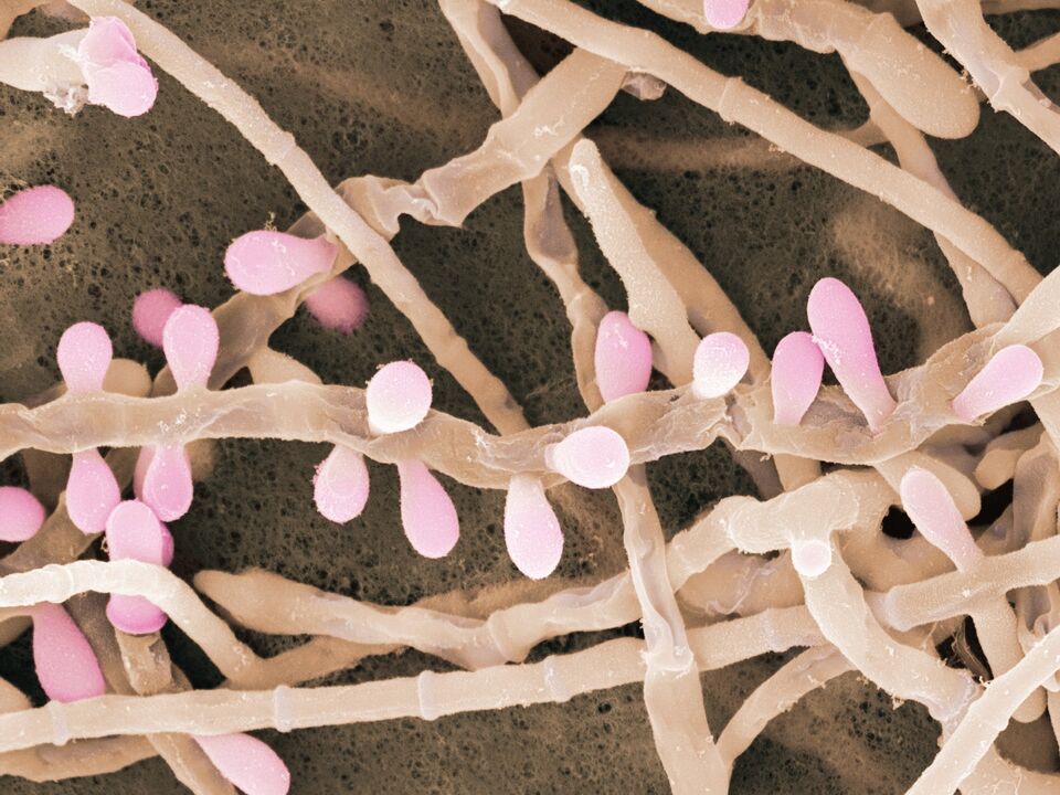Trichophyton rubrum, ayak derisini etkileyen bir mantar türüdür.